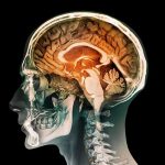 Brainy Bits: Understanding Neurological Disorders